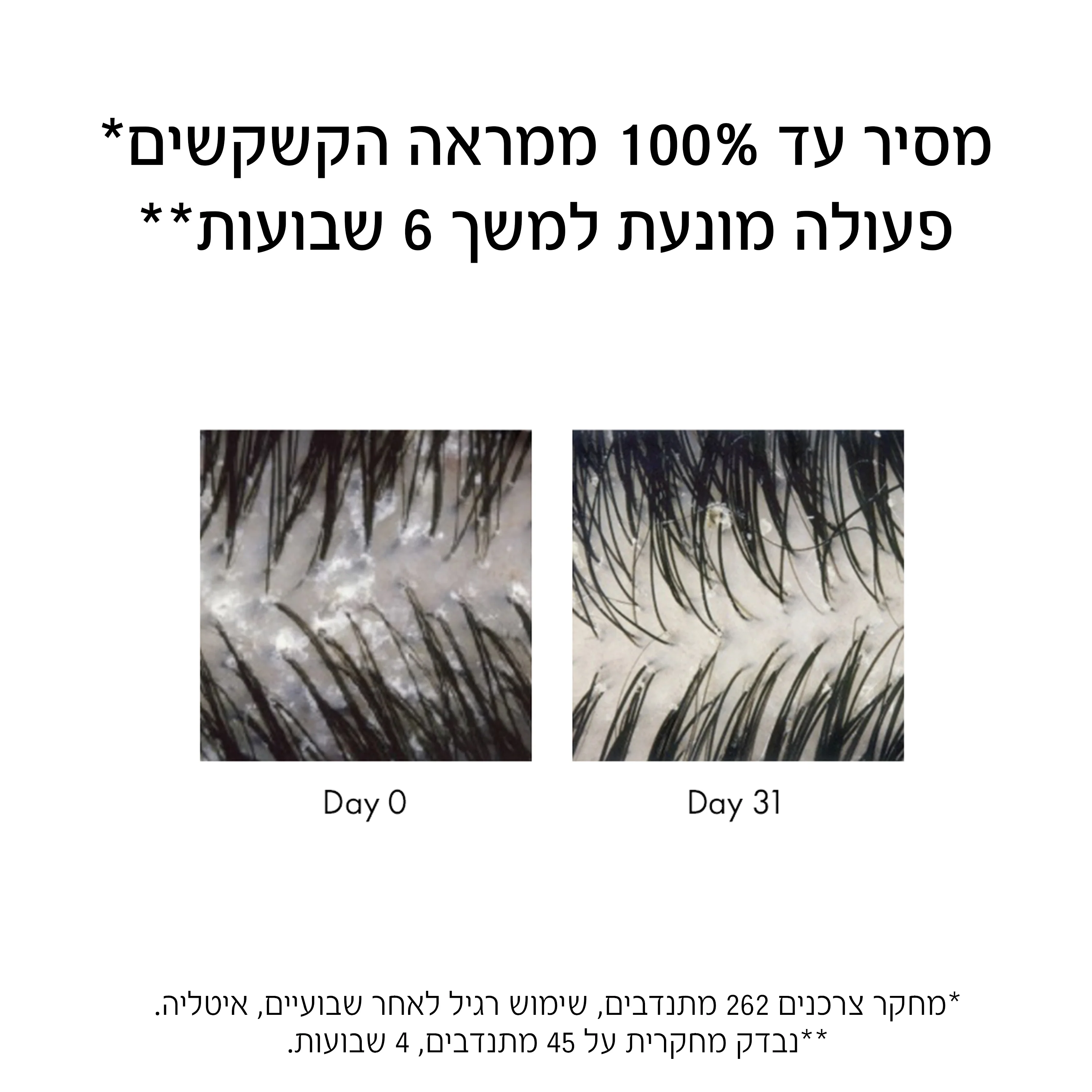 תמונה ממוזערת 4